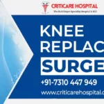 Knee Replacement Surgery Treatment at Lucknow