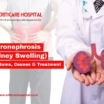 Hydronephrosis (Kidney Swelling): Symptoms, Causes & Treatment