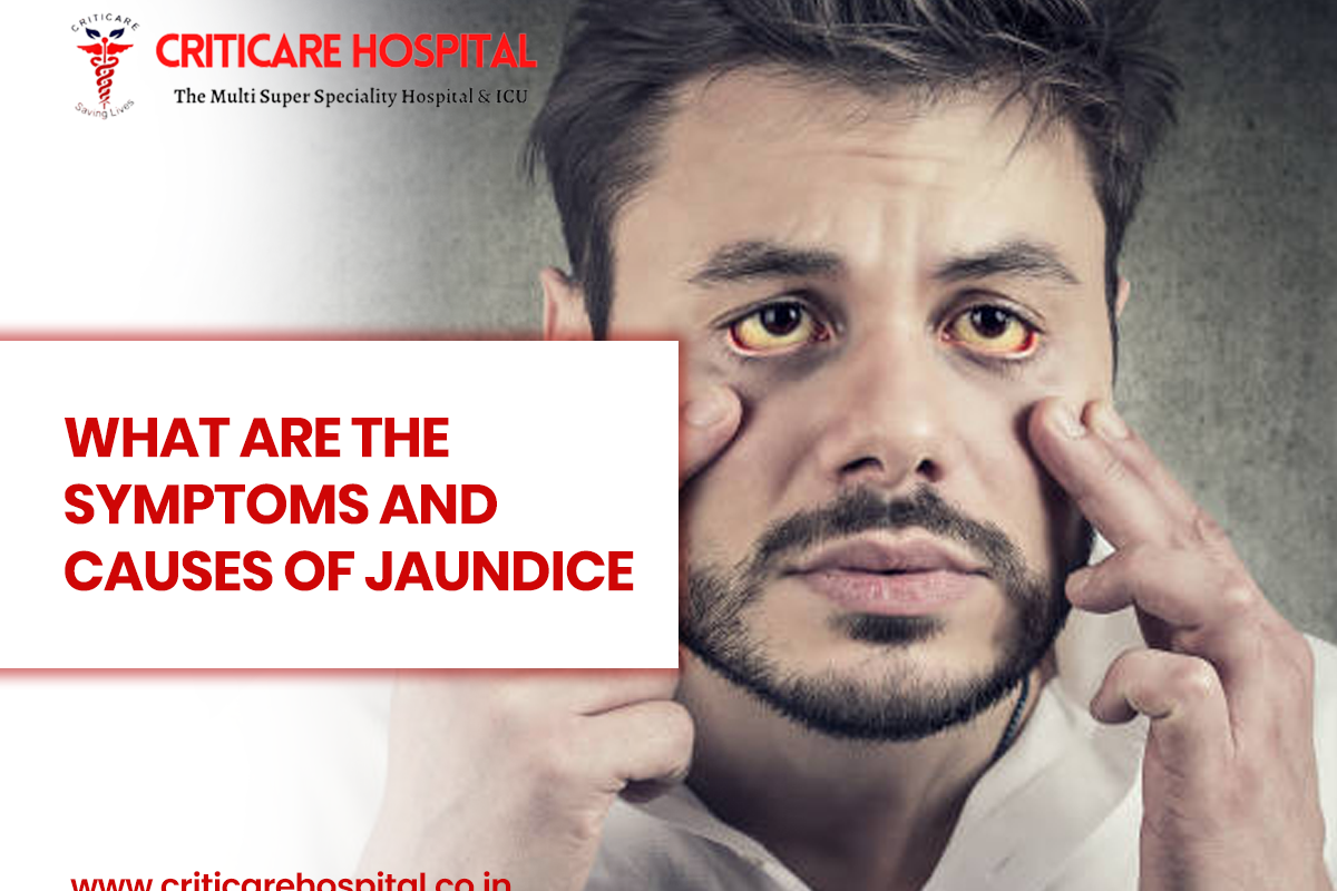 What are the Symptoms and Causes of Jaundice?