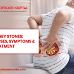 Kidney Stones: Causes, Symptoms & Treatment
