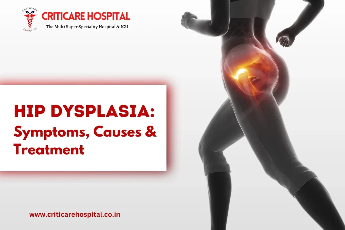 Hip Dysplasia: Symptoms, Causes & Treatment