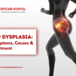 Hip Dysplasia: Symptoms, Causes & Treatment