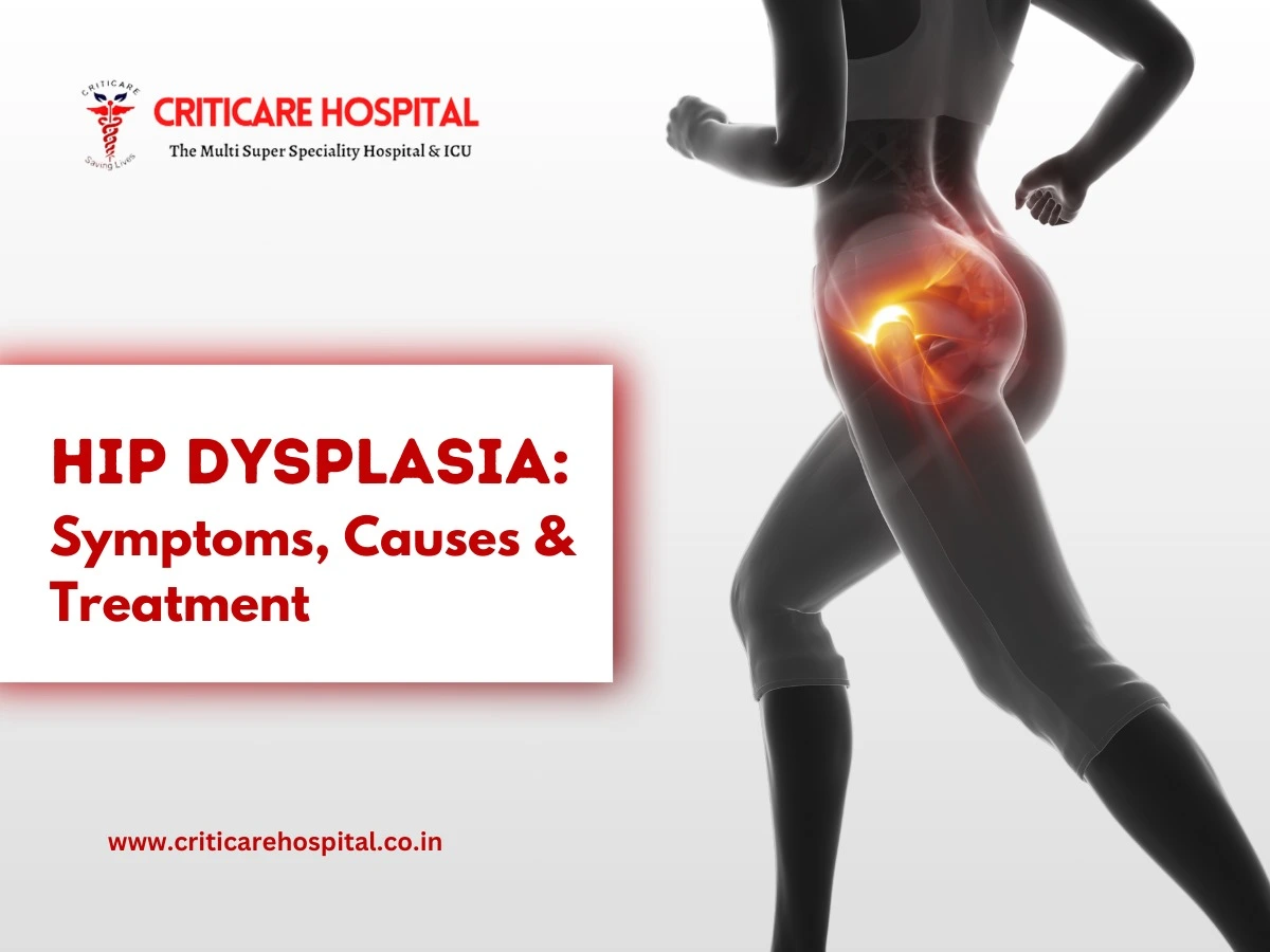 Hip Dysplasia: Symptoms, Causes & Treatment
