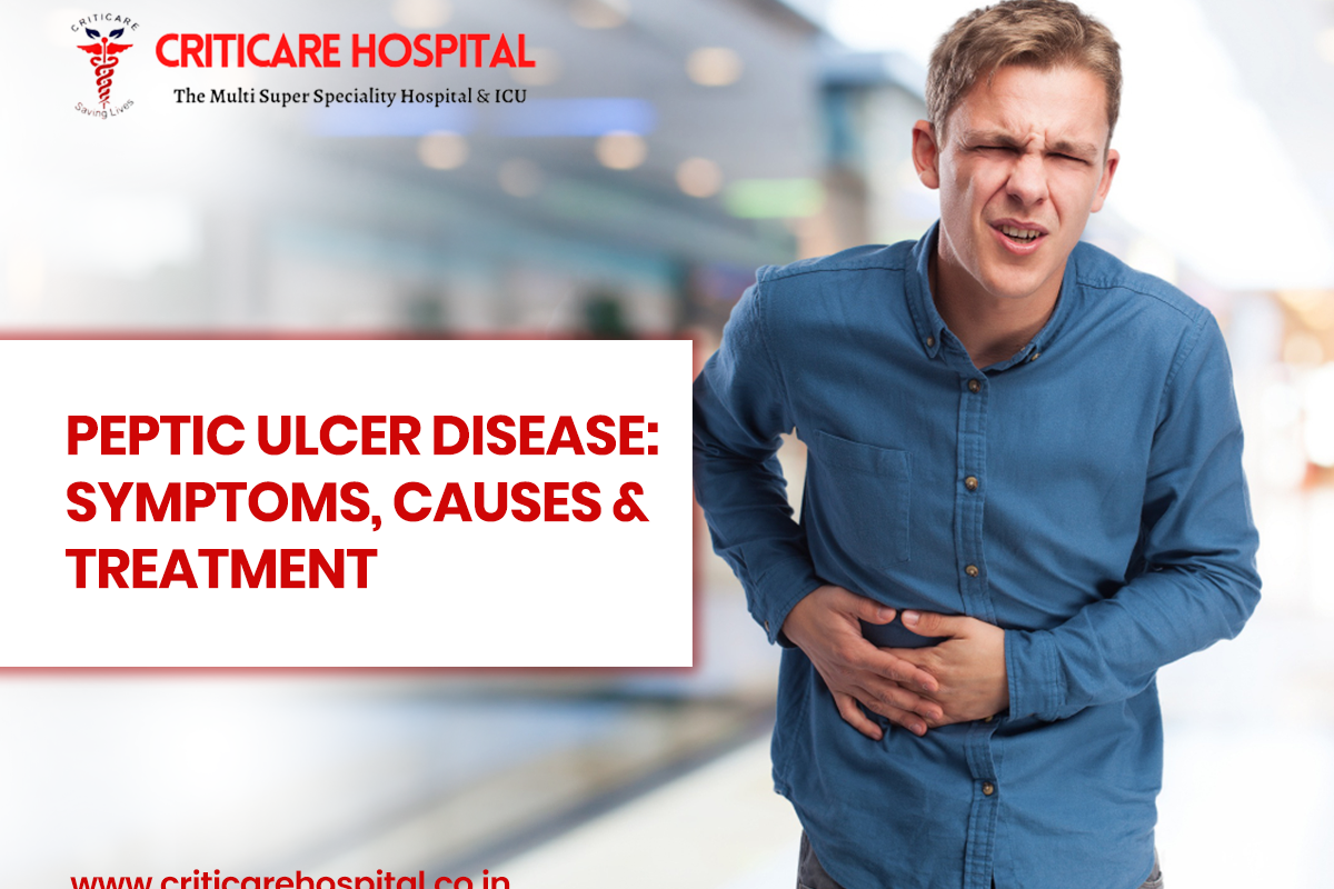 Peptic Ulcer Disease: Symptoms, Causes & Treatment