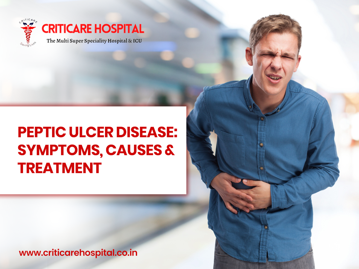 Peptic Ulcer Disease: Symptoms, Causes & Treatment