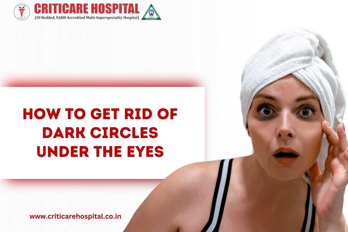under eye dark circles