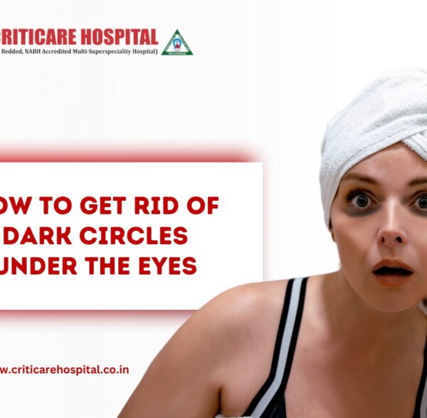 under eye dark circles