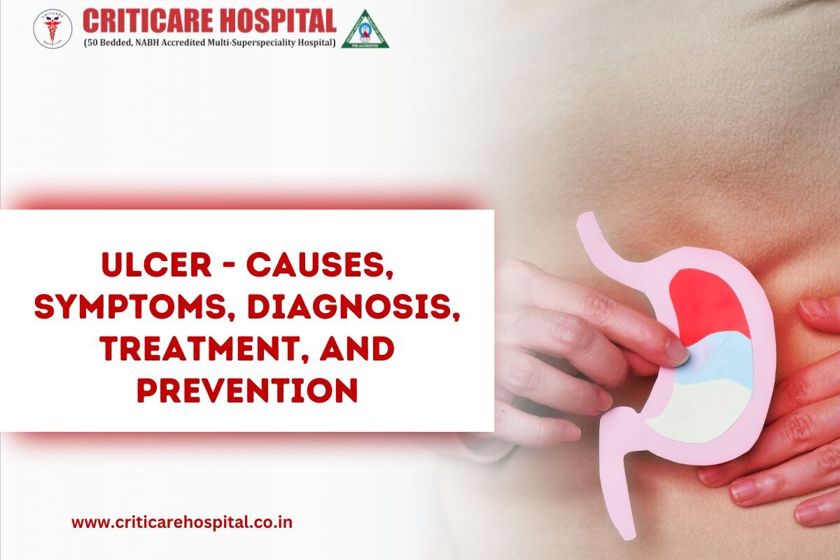 ulcer