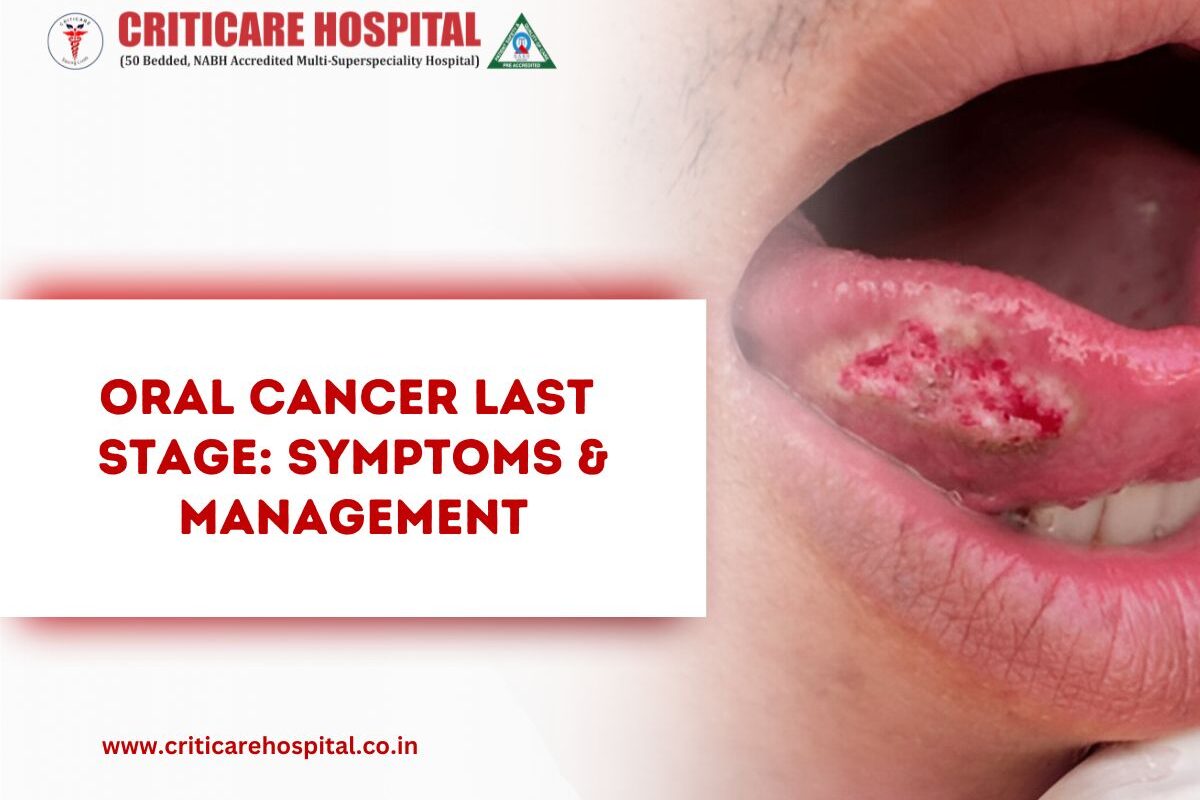 Oral Cancer