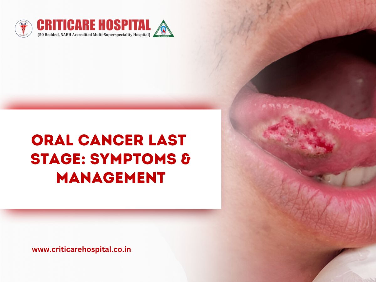 Oral Cancer