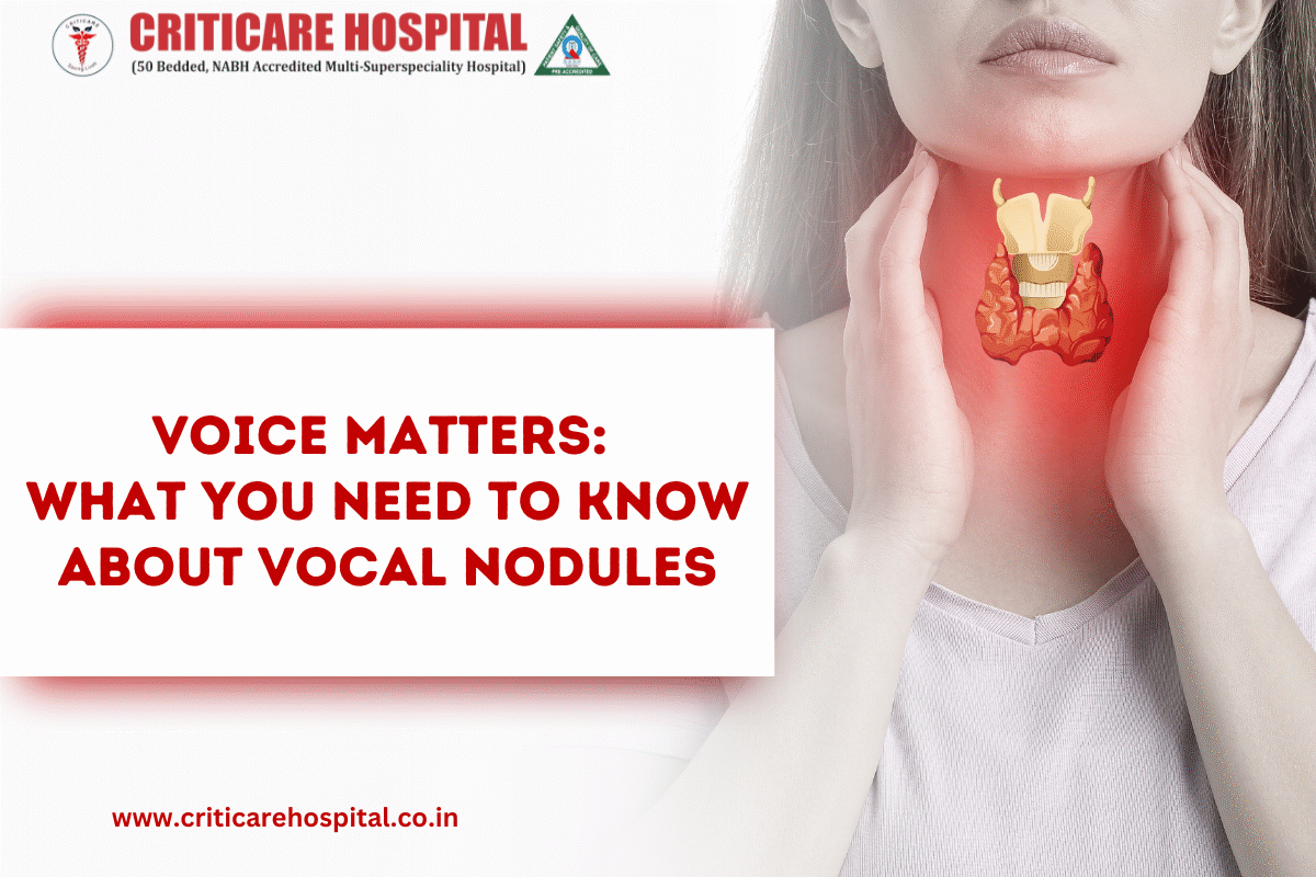 Voice matters: What you need to know about vocal nodules