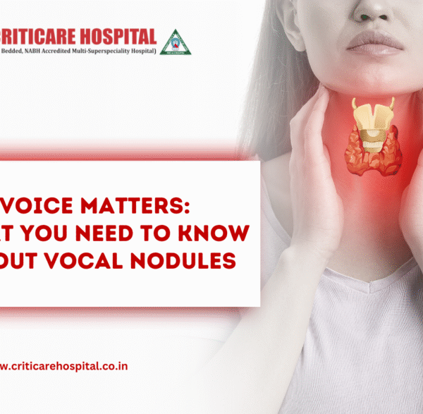 Voice matters: What you need to know about vocal nodules