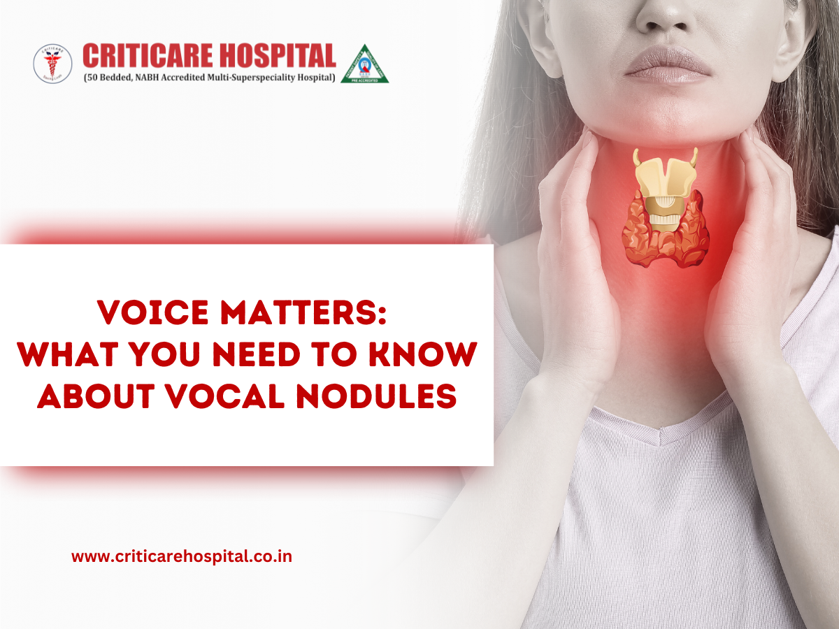 Voice matters: What you need to know about vocal nodules