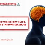 Brain Stroke Short Guide