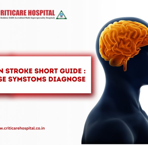Brain Stroke Short Guide