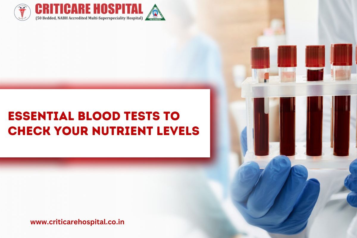 Essential Blood Tests to Check Your Nutrient Levels
