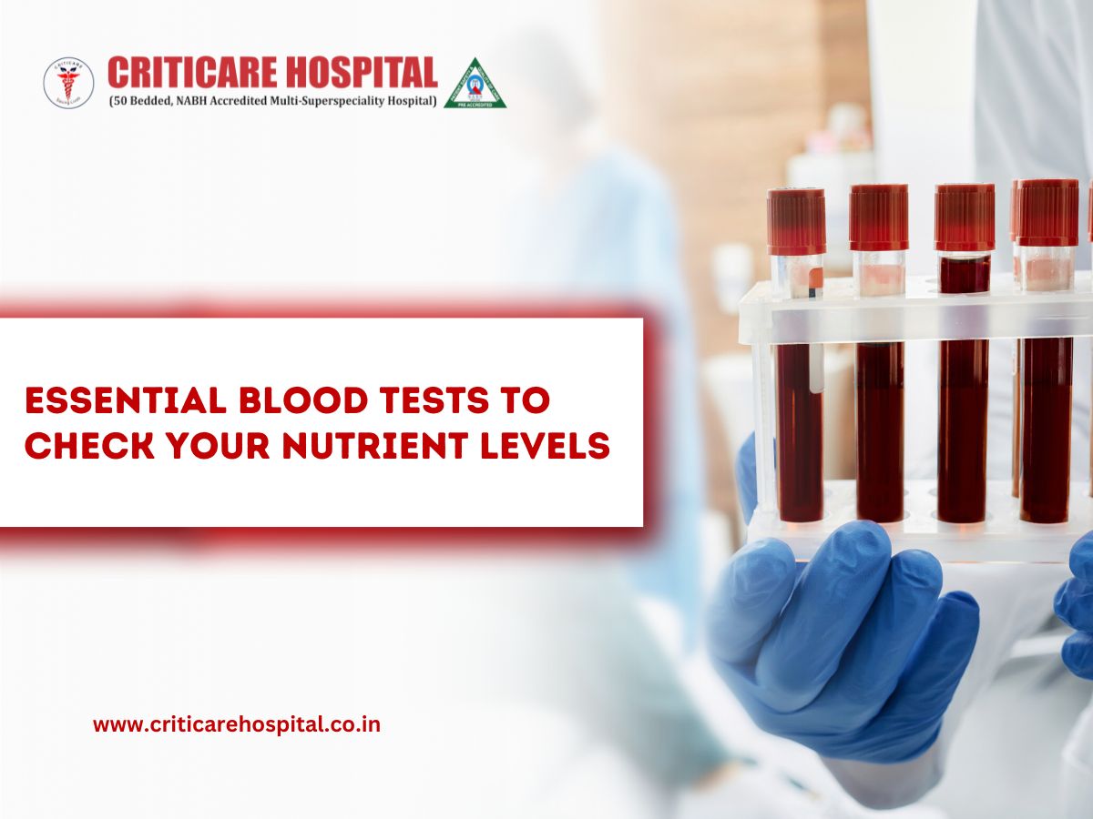 Essential Blood Tests to Check Your Nutrient Levels