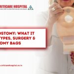 Ileostomy