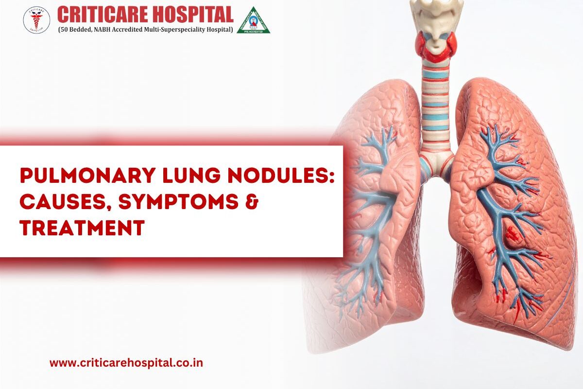Pulmonary Lung Nodules Causes, Symptoms & Treatment