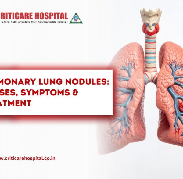 Pulmonary Lung Nodules Causes, Symptoms & Treatment