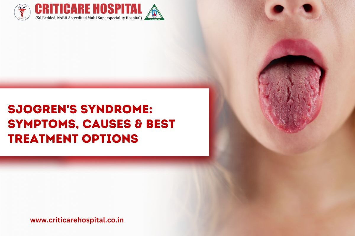 Sjögren’s Syndrome: Symptoms, Causes & Best Treatment Options