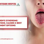 Sjögren’s Syndrome: Symptoms, Causes & Best Treatment Options