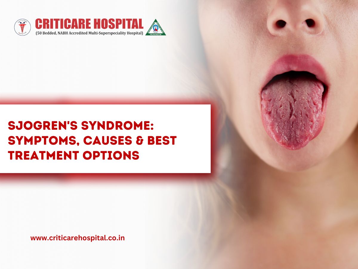 Sjögren’s Syndrome: Symptoms, Causes & Best Treatment Options