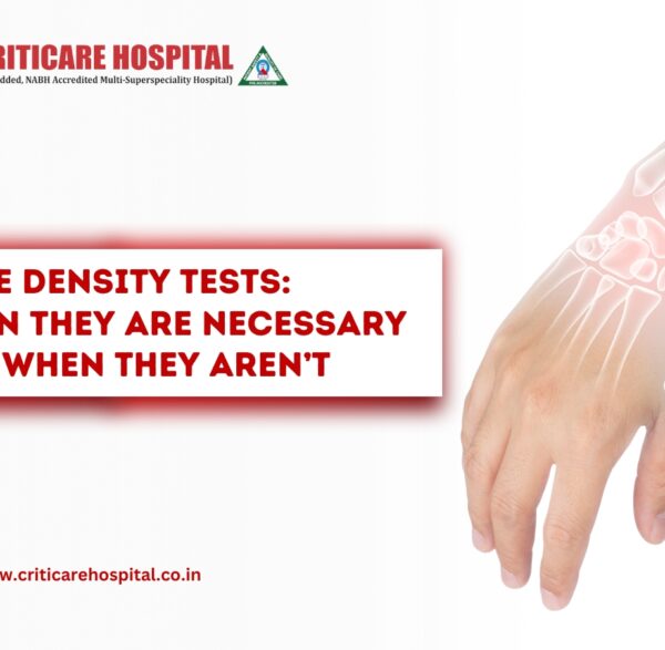 Bone Density Tests