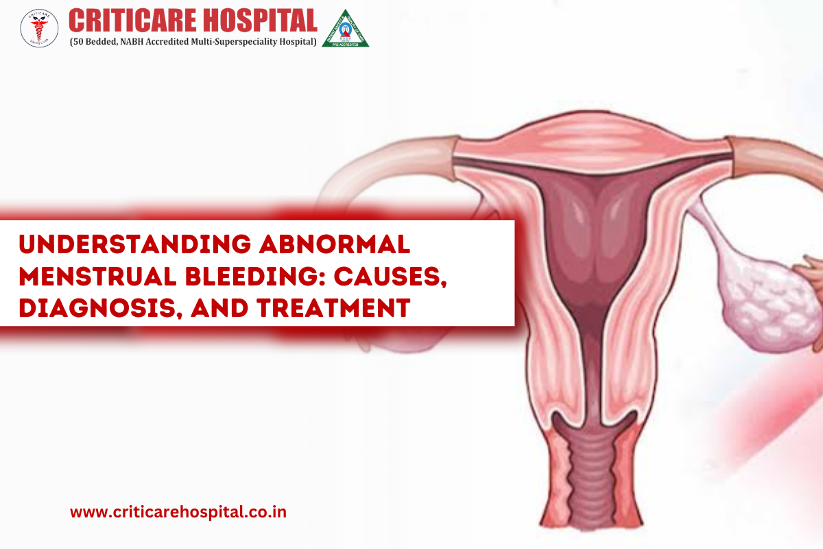 Abnormal Menstrual Bleeding