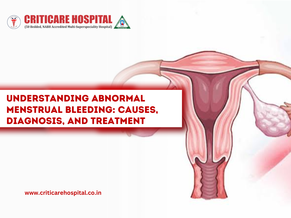 Abnormal Menstrual Bleeding